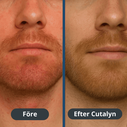Cutalyn® Duo+ ⎜ Målriktad lindring för skägg och hårbotten