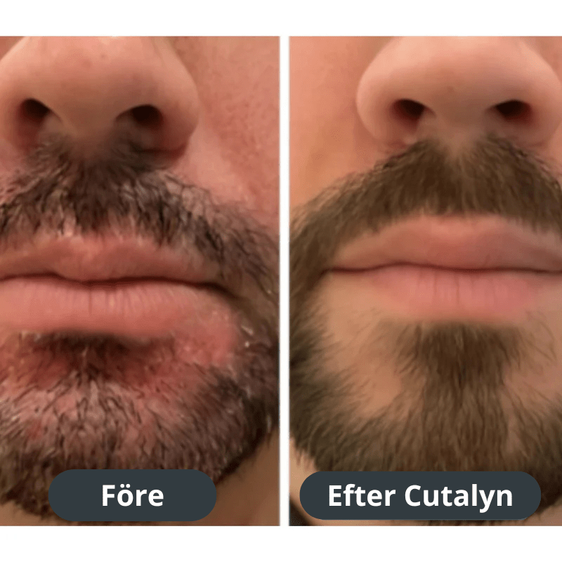 Cutalyn® Duo+ ⎜ Målriktad lindring för skägg och hårbotten